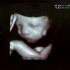 USG w ciąży: zwykłe, 3D, 4D
